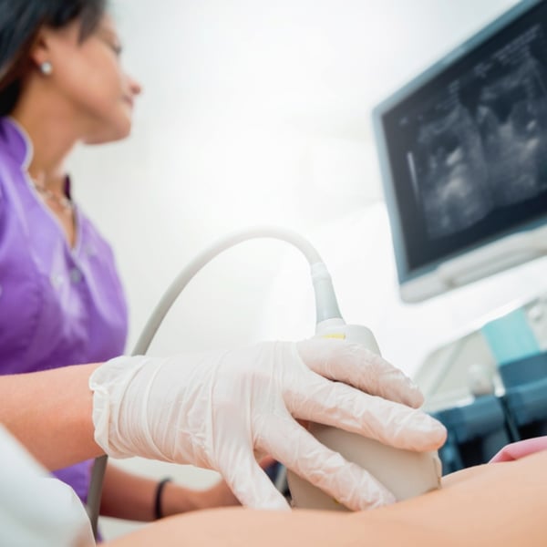 Everything You Need to Know About Ultrasounds